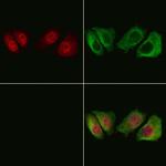 Phospho-HSP20 (Ser16) Polyclonal Antibody
