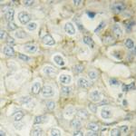 Phospho-HSP20 (Ser16) Antibody in Immunohistochemistry (Paraffin) (IHC (P))
