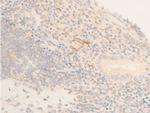Phospho-HSP20 (Ser16) Antibody in Immunohistochemistry (Paraffin) (IHC (P))