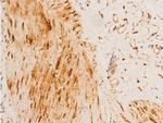Phospho-HSP20 (Ser16) Antibody in Immunohistochemistry (Paraffin) (IHC (P))