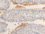 Phospho-HSP20 (Ser16) Antibody in Immunohistochemistry (Paraffin) (IHC (P))