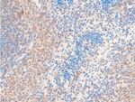 Phospho-HSP20 (Ser16) Antibody in Immunohistochemistry (Paraffin) (IHC (P))
