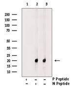 Phospho-HSP20 (Ser16) Antibody in Western Blot (WB)