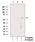 Phospho-Chk1 (Ser345) Antibody in Western Blot (WB)