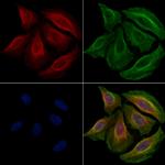 Phospho-IKK beta (Tyr188) Polyclonal Antibody