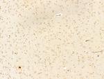 Phospho-IKK beta (Tyr188) Antibody in Immunohistochemistry (Paraffin) (IHC (P))
