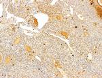 Phospho-IKK beta (Tyr188) Antibody in Immunohistochemistry (Paraffin) (IHC (P))