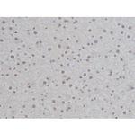 Phospho-IKK alpha/beta (Ser180, Ser181) Antibody in Immunohistochemistry (Paraffin) (IHC (P))