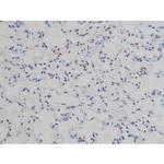 Phospho-IKK alpha/beta (Ser180, Ser181) Antibody in Immunohistochemistry (Paraffin) (IHC (P))