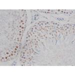 Phospho-IKK alpha/beta (Ser180, Ser181) Antibody in Immunohistochemistry (Paraffin) (IHC (P))