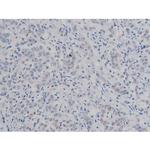 Phospho-IKK alpha/beta (Ser180, Ser181) Antibody in Immunohistochemistry (Paraffin) (IHC (P))