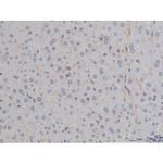 Phospho-IKK alpha/beta (Ser180, Ser181) Antibody in Immunohistochemistry (Paraffin) (IHC (P))
