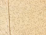 Phospho-IKK alpha/beta (Ser176, Ser177) Antibody in Immunohistochemistry (Paraffin) (IHC (P))