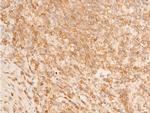 Phospho-p73 (Tyr99) Polyclonal Antibody