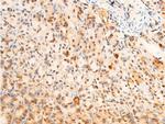 Phospho-PDPK1 (Ser241) Polyclonal Antibody