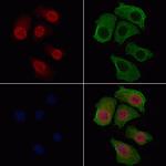 Phospho-FOXO3A (Ser253) Antibody in Immunocytochemistry (ICC/IF)