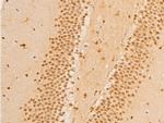 Phospho-FOXO3A (Ser253) Antibody in Immunohistochemistry (Paraffin) (IHC (P))