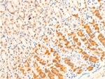 Phospho-FOXO3A (Ser253) Antibody in Immunohistochemistry (Paraffin) (IHC (P))