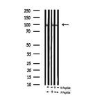 Phospho-FOXO3A (Ser253) Antibody in Western Blot (WB)
