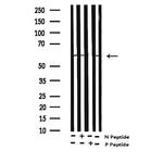 Phospho-DOK2 (Tyr299) Polyclonal Antibody