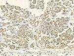 Phospho-JAK2 (Tyr931) Antibody in Immunohistochemistry (Paraffin) (IHC (P))