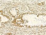 Phospho-JAK2 (Tyr931) Antibody in Immunohistochemistry (Paraffin) (IHC (P))