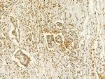 Phospho-JAK2 (Tyr931) Antibody in Immunohistochemistry (Paraffin) (IHC (P))