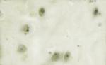 Phospho-JAK2 (Tyr931) Antibody in Immunohistochemistry (Paraffin) (IHC (P))