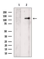 Phospho-JAK2 (Tyr931) Antibody in Western Blot (WB)