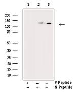 Phospho-JAK2 (Tyr570) Polyclonal Antibody