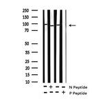 Phospho-NBS1 (Ser343) Polyclonal Antibody