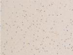 Phospho-MiTF (Ser180) Antibody in Immunohistochemistry (Paraffin) (IHC (P))