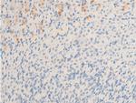 Phospho-MiTF (Ser180) Antibody in Immunohistochemistry (Paraffin) (IHC (P))