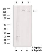 Phospho-ROCK2 (Tyr722) Antibody in Western Blot (WB)
