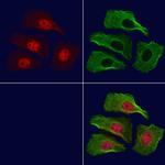 Phospho-MSK1 (Ser376) Polyclonal Antibody