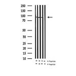 Phospho-MSK1 (Ser376) Antibody in Western Blot (WB)