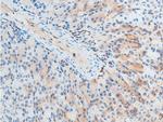 Phospho-Chk2 (Thr387) Polyclonal Antibody