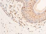 Phospho-Chk2 (Thr383) Antibody in Immunohistochemistry (Paraffin) (IHC (P))