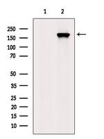 Phospho-EGFR (Thr678) Antibody in Western Blot (WB)