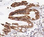 Phospho-EGFR (Thr693) Antibody in Immunohistochemistry (Paraffin) (IHC (P))