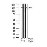 Phospho-EGFR (Thr693) Antibody in Western Blot (WB)