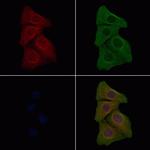 Phospho-EGFR (Tyr1172) Antibody in Immunocytochemistry (ICC/IF)