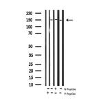 Phospho-EGFR (Tyr1172) Antibody in Western Blot (WB)