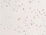 Phospho-EGFR (Ser695) Antibody in Immunohistochemistry (Paraffin) (IHC (P))