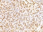 Phospho-EGFR (Ser695) Polyclonal Antibody