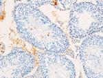 Phospho-EGFR (Ser695) Antibody in Immunohistochemistry (Paraffin) (IHC (P))