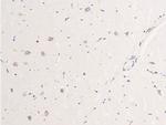 Phospho-EGFR (Ser695) Antibody in Immunohistochemistry (Paraffin) (IHC (P))