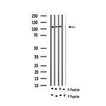 Phospho-EGFR (Ser695) Antibody in Western Blot (WB)