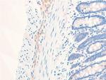 Phospho-EGFR (Ser1026) Antibody in Immunohistochemistry (Paraffin) (IHC (P))