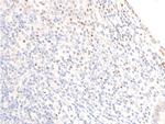 Phospho-EGFR (Ser1071) Polyclonal Antibody